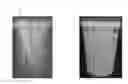 Fig. 01 - Molding container