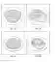 Fig. 05 - Process for producing N-propanol and propionic acid using metabolically engineered propionibacteria