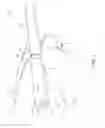 Fig. 02 - ELECTRONIC-CIGARETTE FILTER