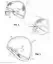 Fig. 03 - Eyewear retaining head covering