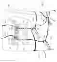 Fig. 10 - Independent Harness System For A Soft Boot