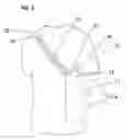 Fig. 03 - Hands-free bag carrying device