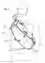 Fig. 05 - Convertible backpack