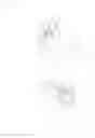 Fig. 12 - Headrest folding apparatus