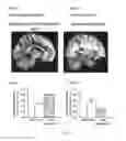 Fig. 02 - WHITE MATTER DIFFUSION TENSOR IMAGING TEST TO PREDICT TREATMENT OUTCOMES IN MEDICAL TREATMENT