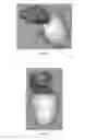 Fig. 06 - NEURONAL IMAGING AND TREATMENT