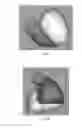 Fig. 09 - NEURONAL IMAGING AND TREATMENT