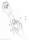 Fig. 08 - DEVICE, COMPUTING DEVICE AND METHOD FOR DETECTING FISTULA STENOSIS
