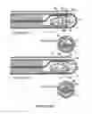 Fig. 06 - Systems and methods for improved visualization during minimally invasive procedures