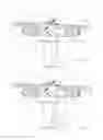 Fig. 02 - Cannula with flexible holder and methods of use