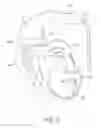 Fig. 03 - PATIENT-SUPPORTED OPHTHALMIC PLATFORMS