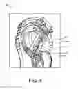 Fig. 04 - Insertion devices, anchors, and methods for securing an implant