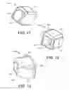Fig. 09 - Insertion devices, anchors, and methods for securing an implant