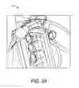 Fig. 15 - Insertion devices, anchors, and methods for securing an implant