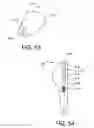 Fig. 27 - Insertion devices, anchors, and methods for securing an implant