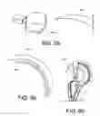 Fig. 29 - Insertion devices, anchors, and methods for securing an implant