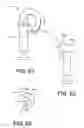 Fig. 30 - Insertion devices, anchors, and methods for securing an implant