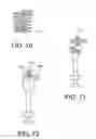 Fig. 34 - Insertion devices, anchors, and methods for securing an implant