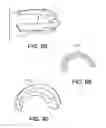 Fig. 40 - Insertion devices, anchors, and methods for securing an implant