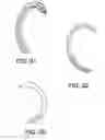 Fig. 41 - Insertion devices, anchors, and methods for securing an implant