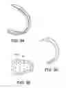 Fig. 42 - Insertion devices, anchors, and methods for securing an implant