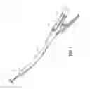 Fig. 02 - Anvil assembly delivery systems