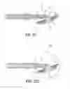 Fig. 15 - Anvil assembly delivery systems