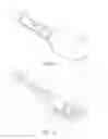 Fig. 17 - Anvil assembly delivery systems