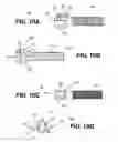 Fig. 09 - Articulated cavity creator