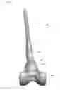 Fig. 23 - Systems and methods for preparing bone voids to receive a prosthesis