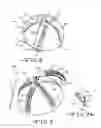 Fig. 06 - Disposable cutter acetabular reamer