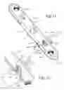 Fig. 07 - Jig with guide adapted to lock relative to both of threaded holes and non-threaded slots in a bone plate