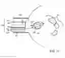 Fig. 10 - IMAGE-BASED COMPUTER-AIDED SAFE STONE EXTRACTION ADVISOR