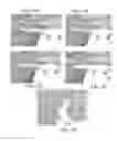 Fig. 08 - Steerable medical device