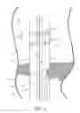 Fig. 05 - Devices and methods for treating lower extremity vasculature