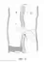 Fig. 08 - Devices and methods for treating lower extremity vasculature