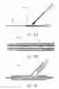 Fig. 16 - Devices and methods for treating lower extremity vasculature