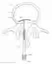 Fig. 01 - Bone anchor systems