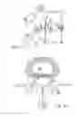 Fig. 02 - Bone anchor systems