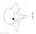 Fig. 11 - Bone anchor systems
