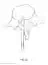 Fig. 13 - Bone anchor systems