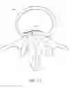 Fig. 28 - Bone anchor systems