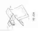Fig. 37 - Bone anchor systems