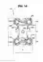 Fig. 02 - SPINAL FIXATION PLATES
