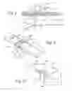 Fig. 06 - Method of dynamically compressing a fracture