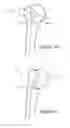 Fig. 02 - Articular fracture fixation system and method