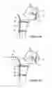 Fig. 04 - Articular fracture fixation system and method