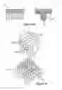Fig. 09 - Articular fracture fixation system and method