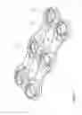 Fig. 02 - Resiliant spinal plate system