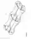 Fig. 06 - Resiliant spinal plate system